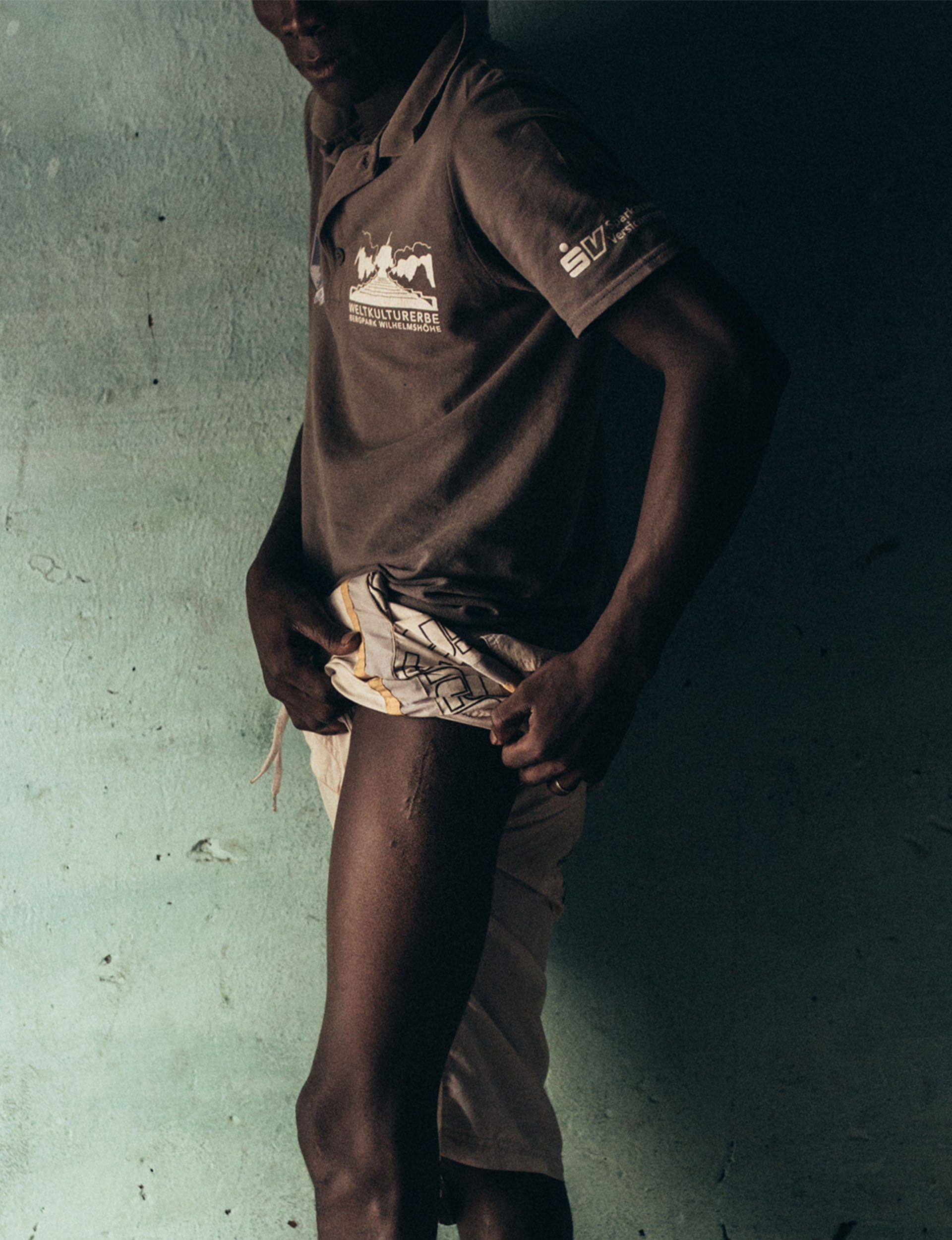 migrante gamba cicatrice Guinea Bissau Mani Tese 2017