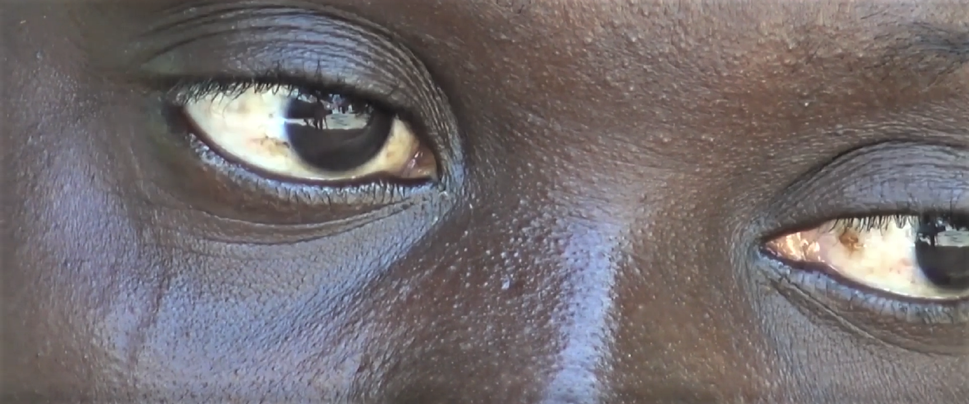 grida di dolore guinea bissau mani tese 2021